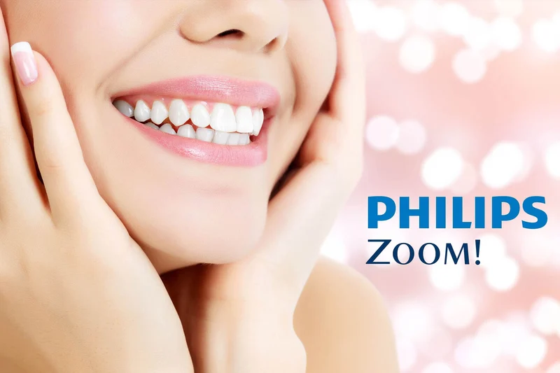 Philips Zoom Chairside Whitening Kit Gel 6% con Nite White